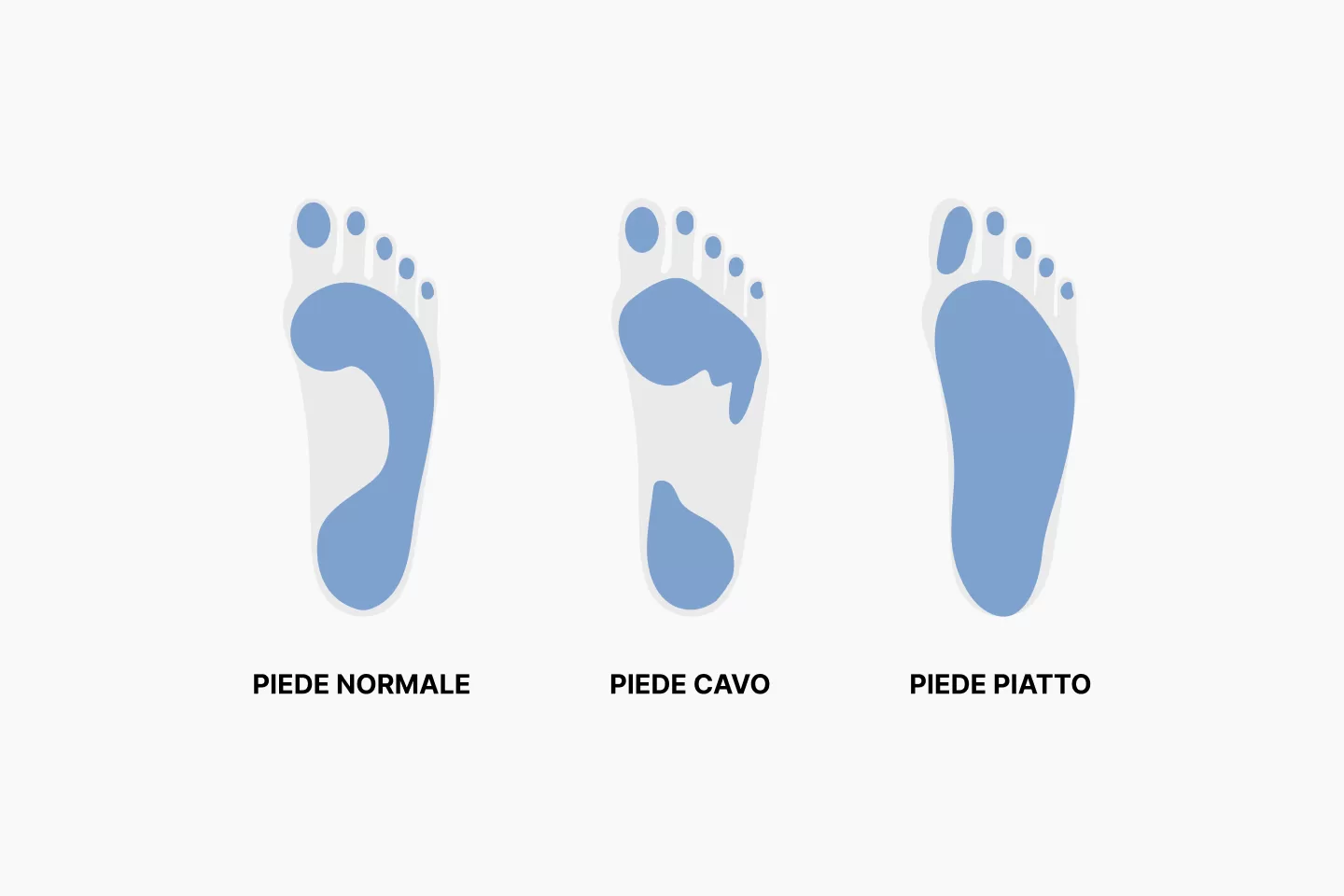 Anomalie nell’assetto del piede piatto o cavo, Studio Podologico DiPalma a Lodi