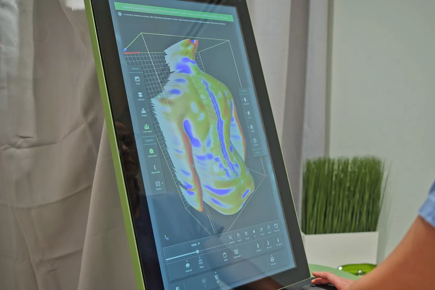 Visita posturale con tecnologia Spine 3D presso lo Studio Podologico DiPalma a Lodi